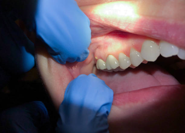 Best Emergency Cosmetic Dentistry in Goldens Bridge, NY