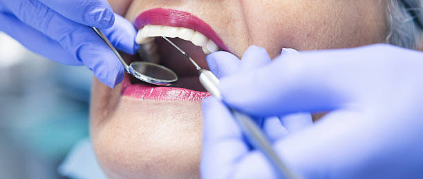 Best Emergency Dentist for Lost Fillings or Crowns in Goldens Bridge, NY